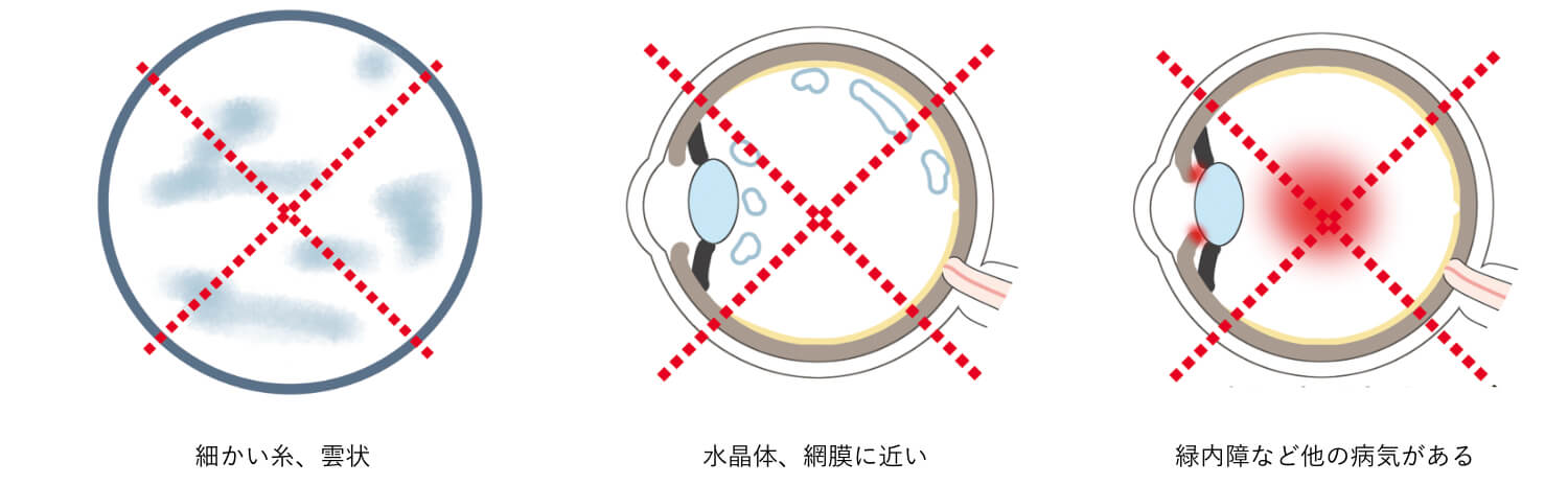 飛 蚊 症 治し 方 知恵袋